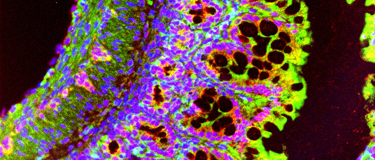 Immunfluoreszenzfärbung eines Mausdarms. Gefärbt wurden Makrophagen (grün) und S100A8/A9 (rot). 